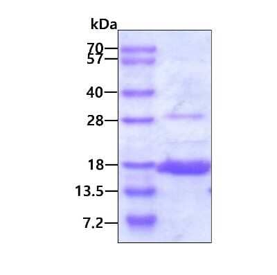 SDS-PAGE: Recombinant Human AKAP7 His Protein [NBP1-99000]